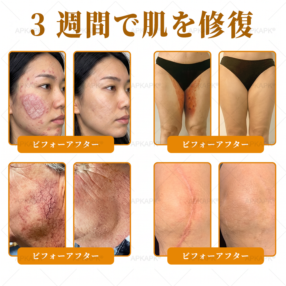 エイジング悩み対策サポート🐝🥇 𝖠𝖯𝖪𝖠𝖯𝖪® ハチ毒トータルスキンケアクリーム🔥