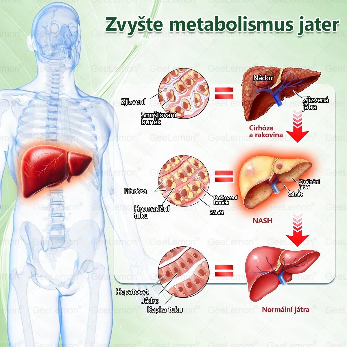 💥🎁 𝐆𝐞𝑒𝑙𝑒𝐦𝐨𝐧® Glum𝐚𝐬𝐞tide 8 v 1 – Zeštíhlující nano mikrojihlový náplast 🇨🇿 Jen 1× denně ✅ Viditelné změny za 7 dní – na obezitu, kardiovaskulární zdraví, diabetes a kloubní problémy