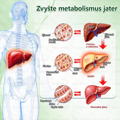 💥🎁 𝐆𝐞𝑒𝑙𝑒𝐦𝐨𝐧® Glum𝐚𝐬𝐞tide 8 v 1 – Zeštíhlující nano mikrojihlový náplast 🇨🇿 Jen 1× denně ✅ Viditelné změny za 7 dní – na obezitu, kardiovaskulární zdraví, diabetes a kloubní problémy