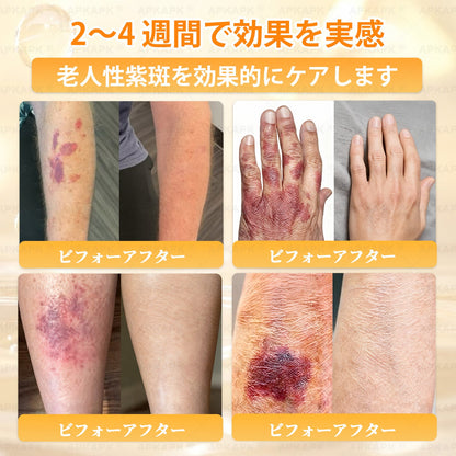 エイジング悩み対策サポート🐝🥇 𝖠𝖯𝖪𝖠𝖯𝖪® ハチ毒トータルスキンケアクリーム🔥