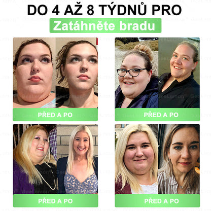 💥🎁 𝐆𝐞𝑒𝑙𝑒𝐦𝐨𝐧® Glum𝐚𝐬𝐞tide 8 v 1 – Zeštíhlující nano mikrojihlový náplast 🇨🇿 Jen 1× denně ✅ Viditelné změny za 7 dní – na obezitu, kardiovaskulární zdraví, diabetes a kloubní problémy