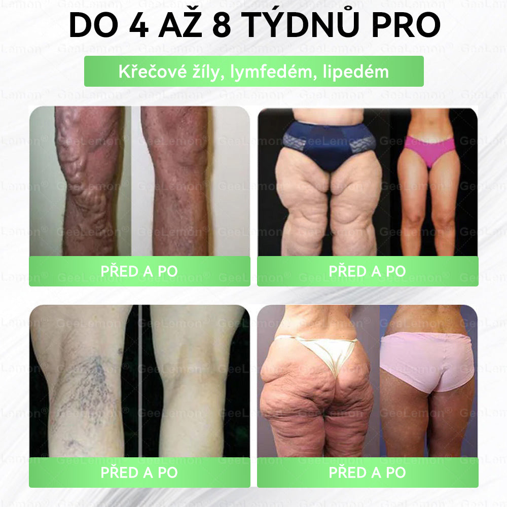 💥🎁 𝐆𝐞𝑒𝑙𝑒𝐦𝐨𝐧® Glum𝐚𝐬𝐞tide 8 v 1 – Zeštíhlující nano mikrojihlový náplast 🇨🇿 Jen 1× denně ✅ Viditelné změny za 7 dní – na obezitu, kardiovaskulární zdraví, diabetes a kloubní problémy