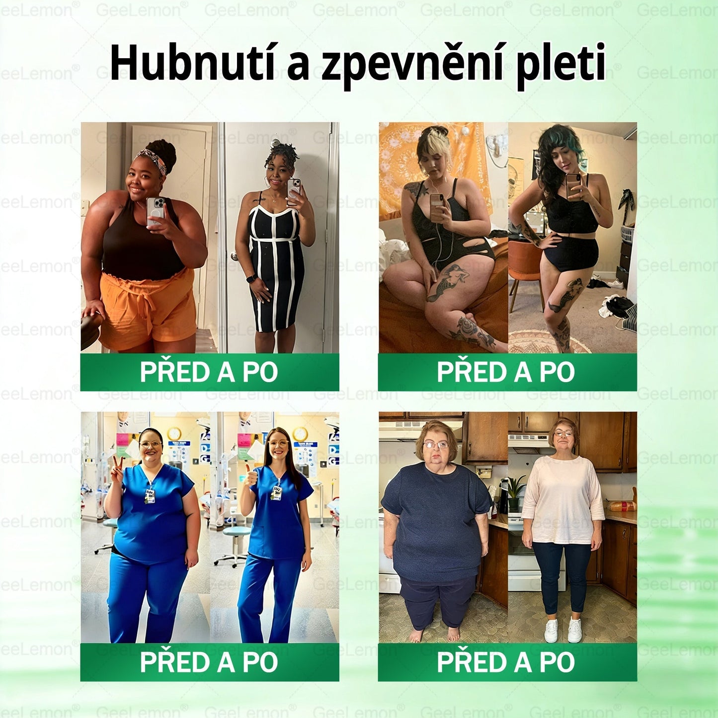 💥🎁 𝐆𝐞𝑒𝑙𝑒𝐦𝐨𝐧® Glum𝐚𝐬𝐞tide 8 v 1 – Zeštíhlující nano mikrojihlový náplast 🇨🇿 Jen 1× denně ✅ Viditelné změny za 7 dní – na obezitu, kardiovaskulární zdraví, diabetes a kloubní problémy