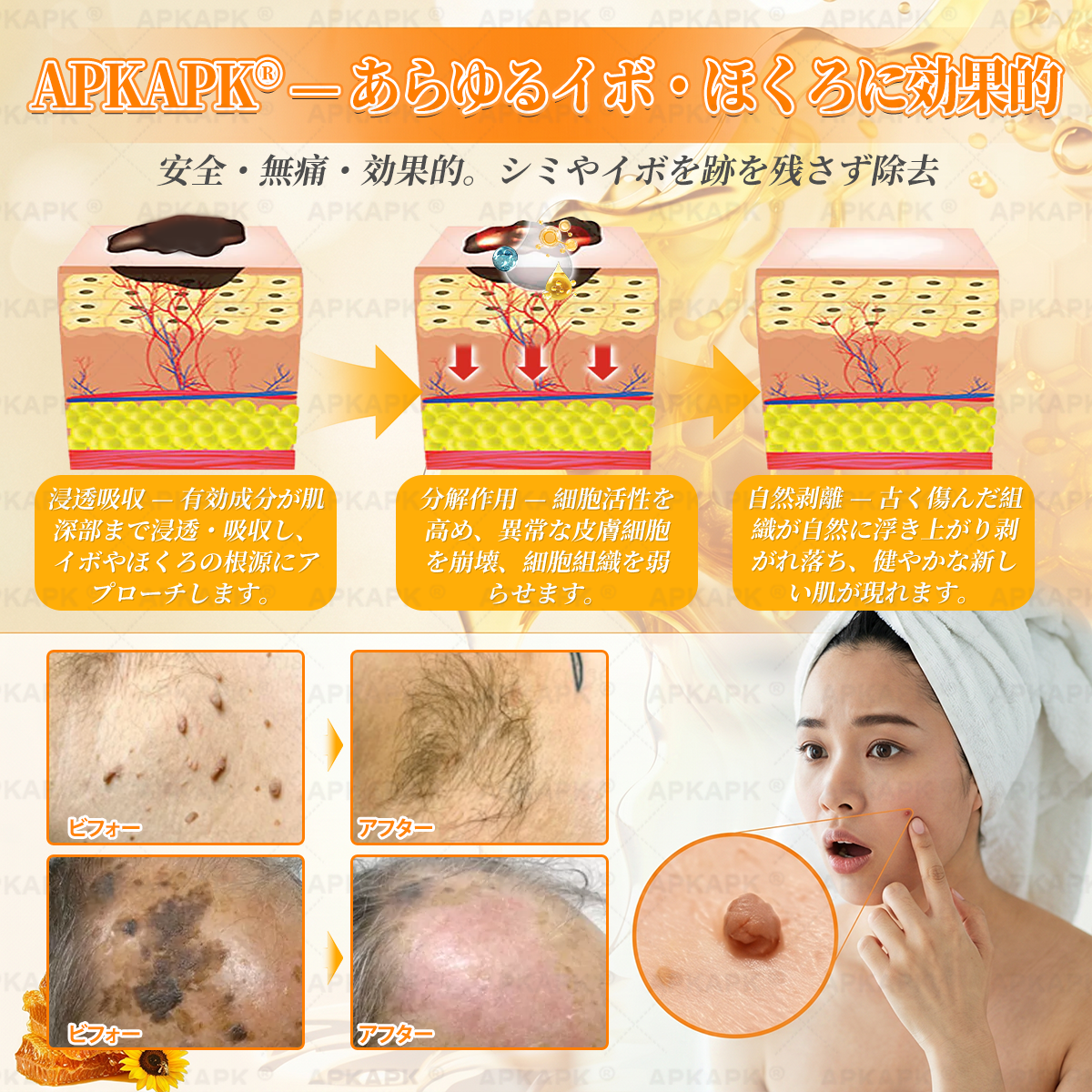 エイジング悩み対策サポート🐝🥇 𝖠𝖯𝖪𝖠𝖯𝖪® ハチ毒トータルスキンケアクリーム🔥