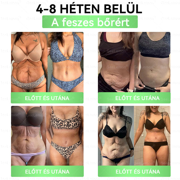 50% KEDVEZMÉNY ❤️ GeeLemon® Glumasetide 8 az 1-ben Nano Mikrotűs Tapasz | Moringa · Berberine · NAD+ | Napi 1× | Csak most!